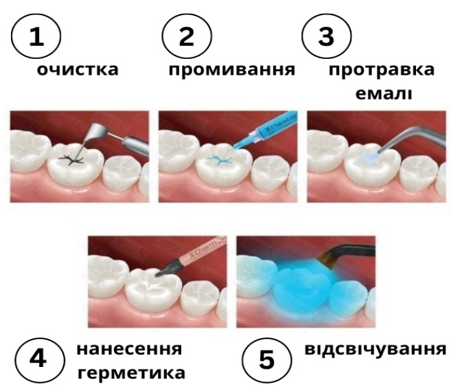 Як проводиться процедура: