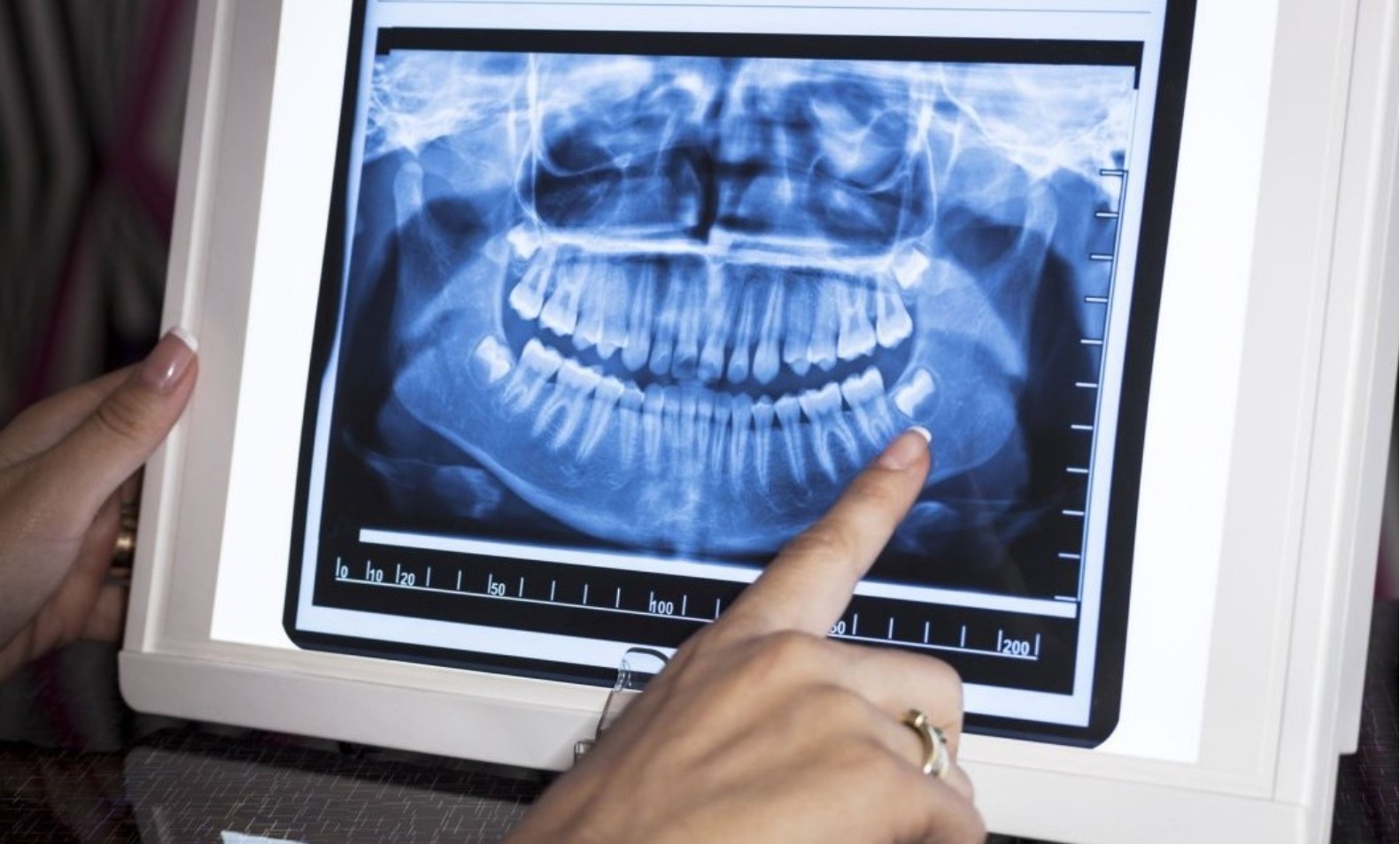 Діагностика в стоматології