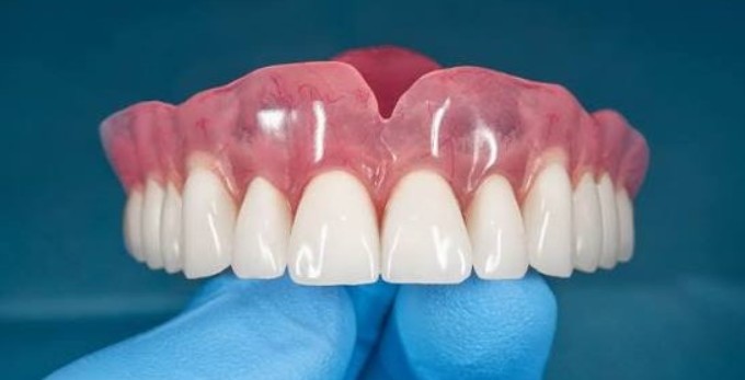 Акрилові протези: доступне рішення