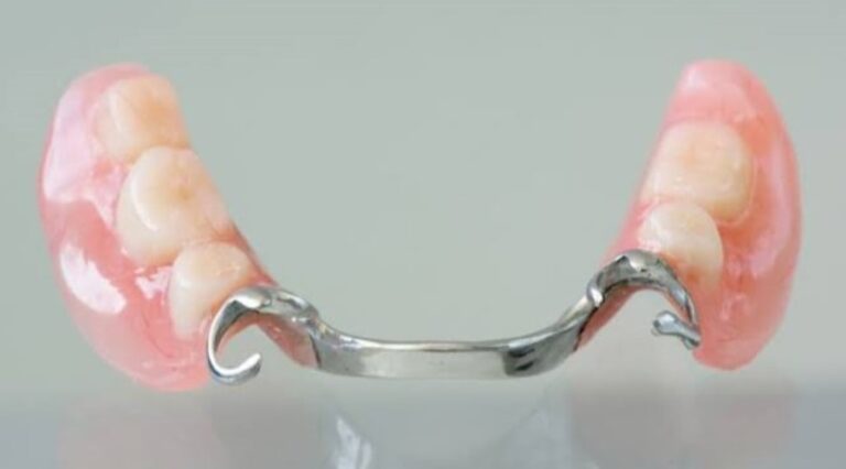 Бюгельні протези