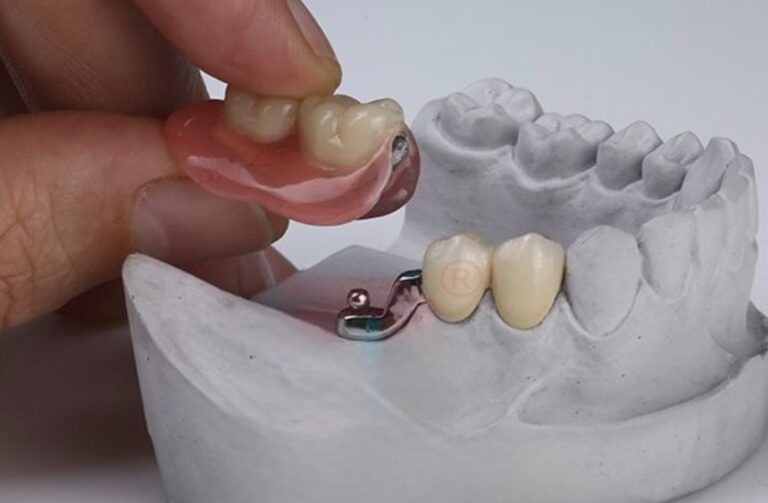 Мікро - протез на замках