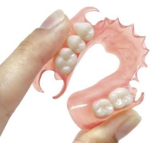 Нейлонові протези: гнучкість та комфорт